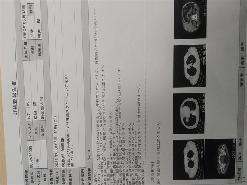 CT検査 異常なし